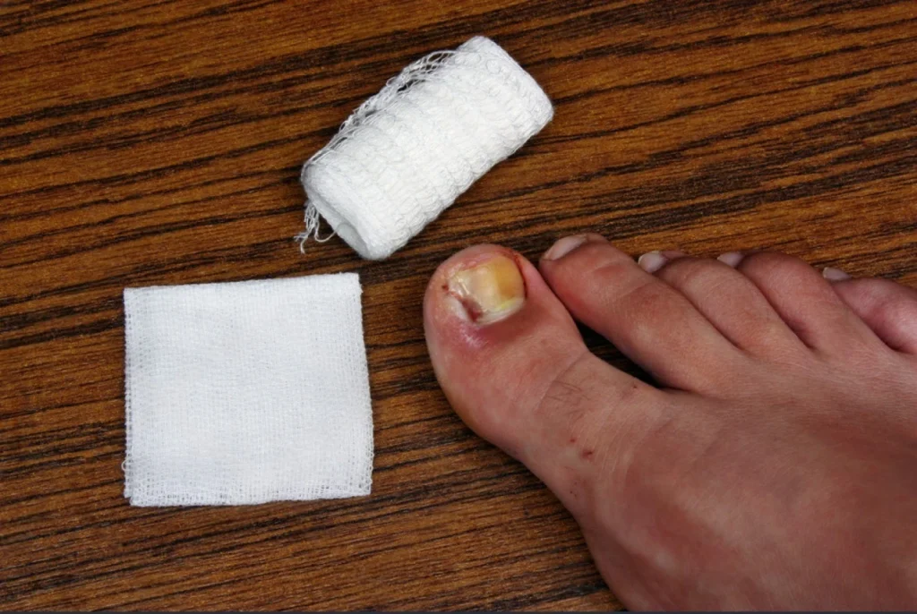 pain in toenail