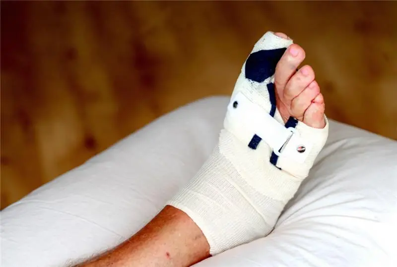 hammertoe pain treatment