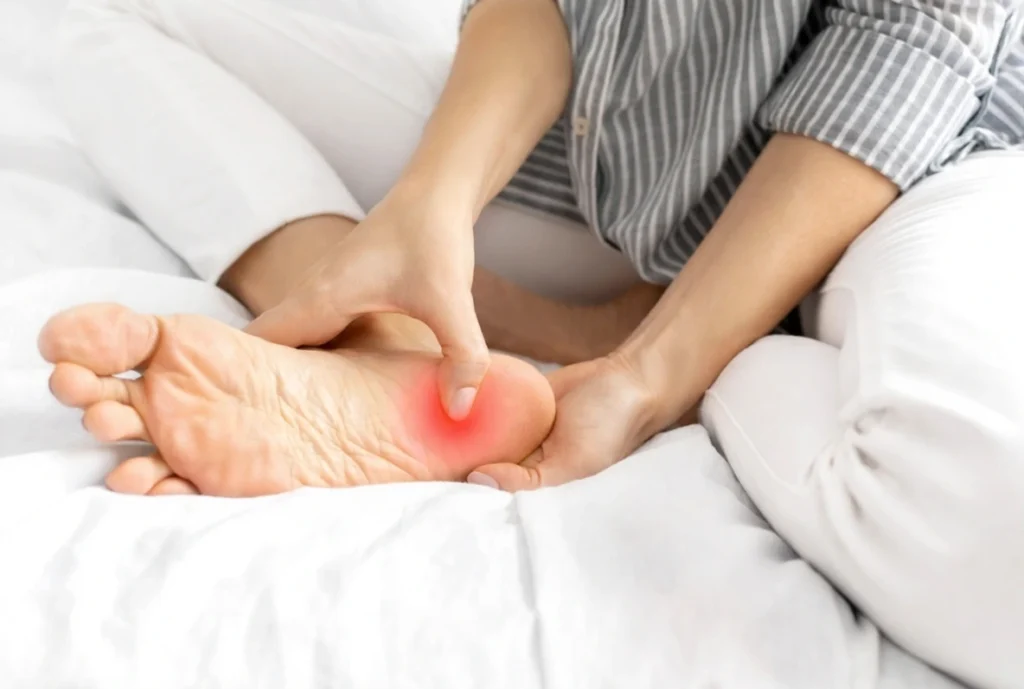 Plantar Fasciitis