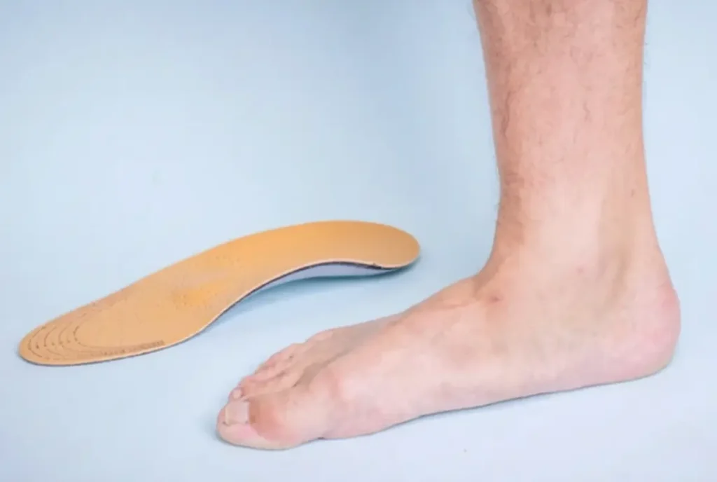 flat feet how to fix