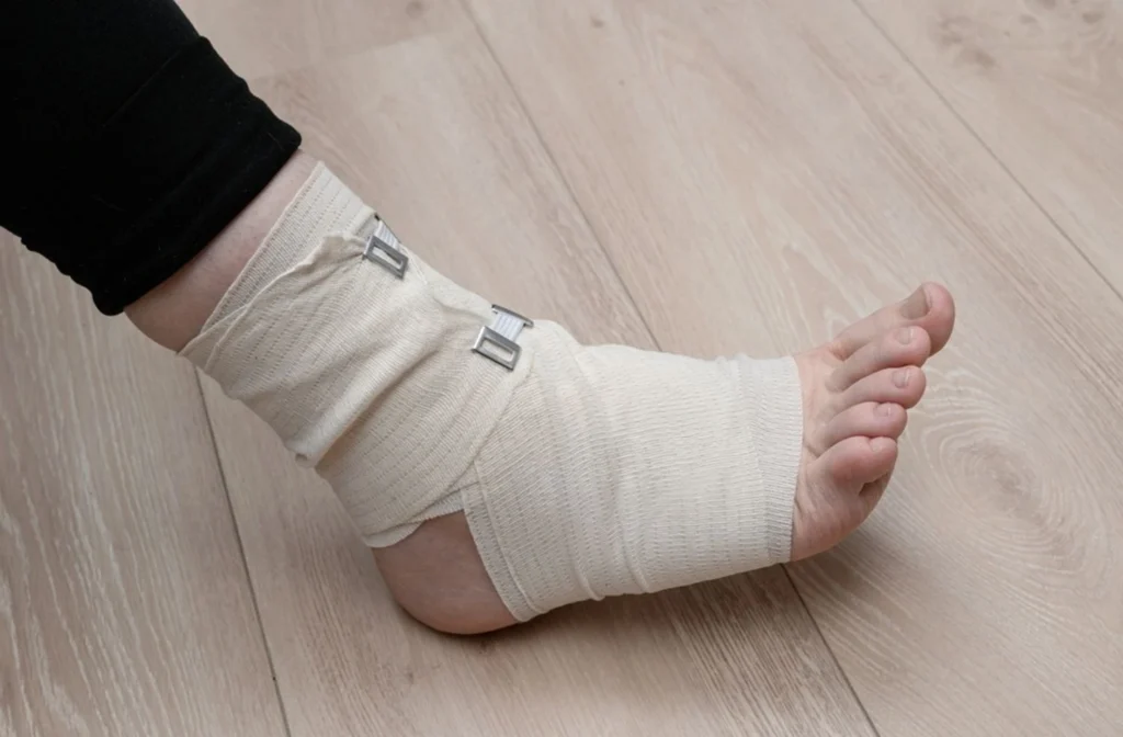 Ankle Sprain